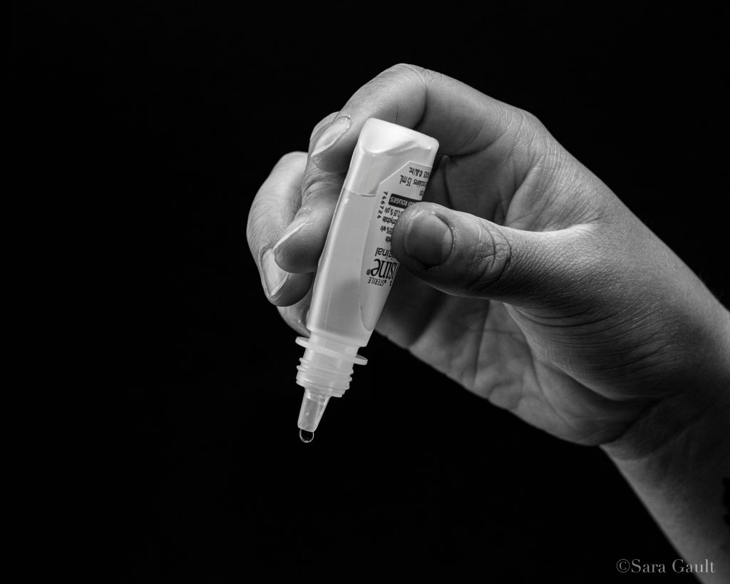 dry eye syndrome symptoms and treatment